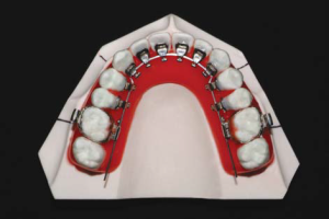 Базовый практический курс по лингвальной ортодонтии